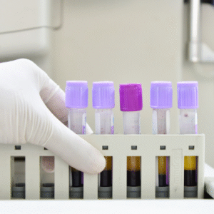 Complete Blood Count (CBC)(Just Started )