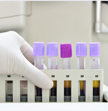 Complete Blood Count (CBC)(Just Started )