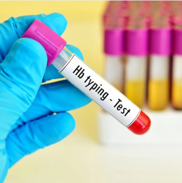 Hemoglobin (Hb)(Just Started )