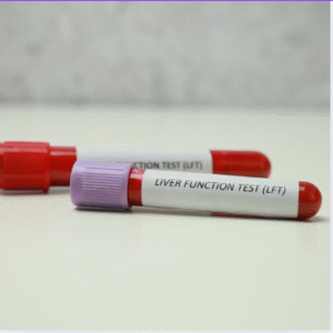 Liver Function Test (LFT)(Just Started )