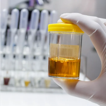 Routine Urine Analysis(Just Started )